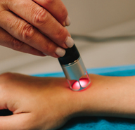Targeted Laser Therapy
