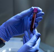 Support Systemic Recovery and Resilience