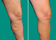 Before and After Treatment