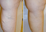 Before and After Treatment