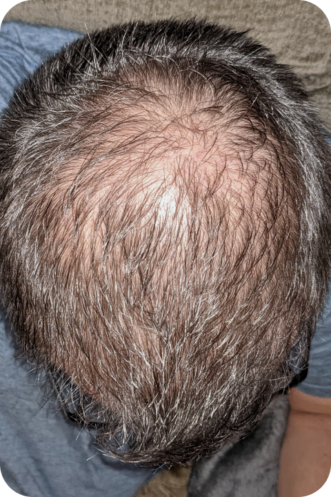 Steve before