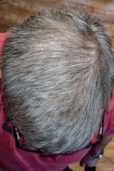 Steve after