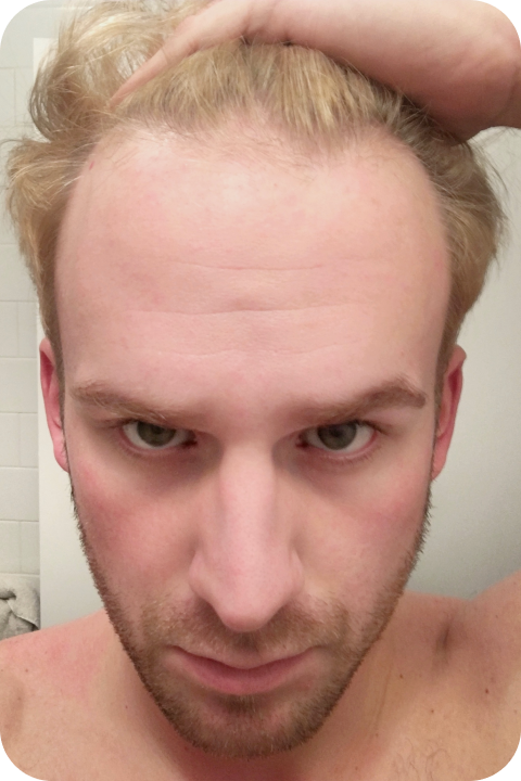 Seth before