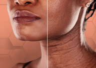 Videocast sobre Terapia de Gênero