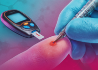 Videocast sobre Hiperglicemia