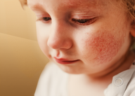 Videocast sobre Hiperglicemia