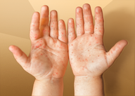 Estudo sobre Obesidade