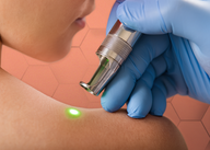 Videocast sobre Hiperglicemia