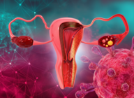 Diretriz sobre Doença Renal