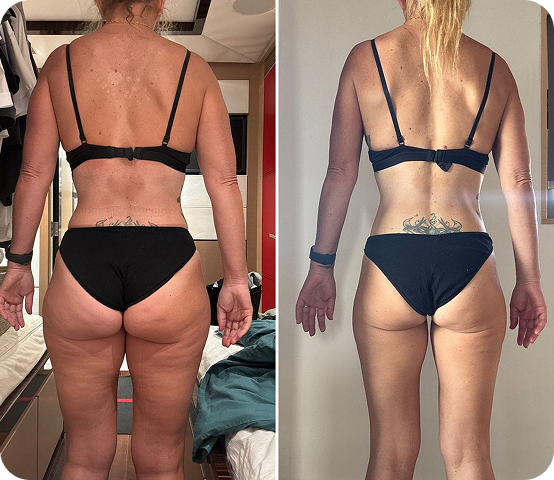 Shell transformation