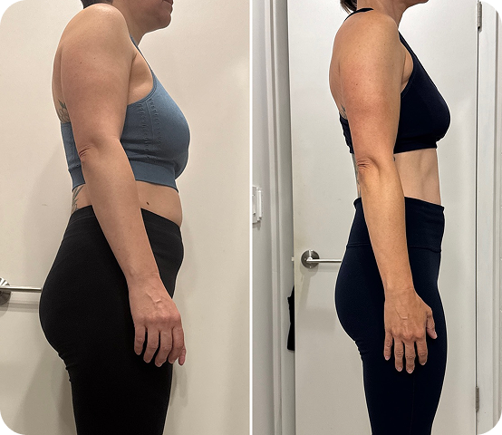 Sharon transformation